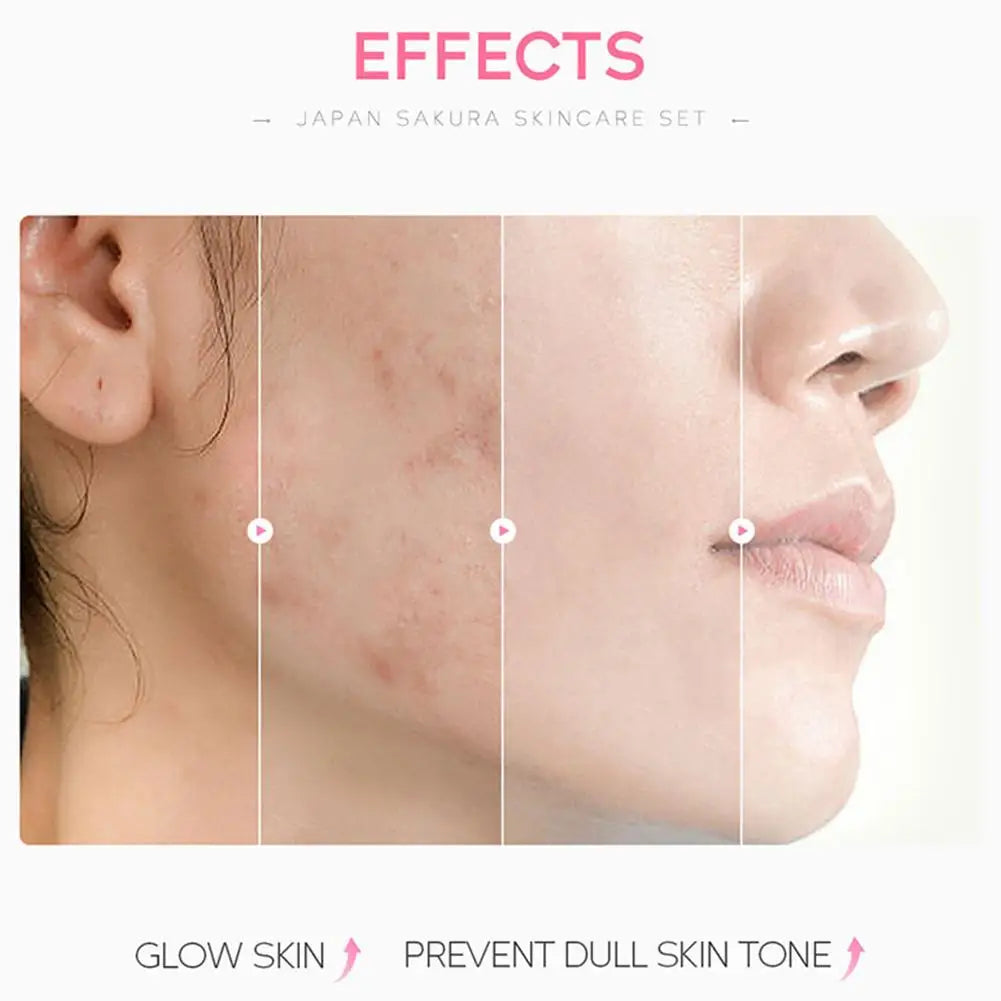 5/3pcs/Set Sakura Skin Care Sets Face Cream Serum Toner Facial Cleanser Sunscreen Eye Cream Gift Box Face Skin Care Set Product